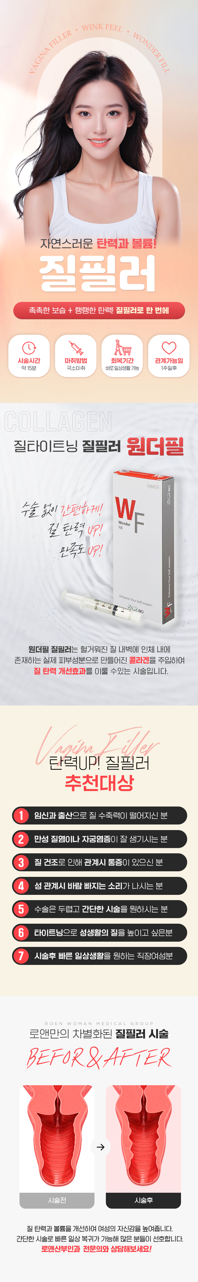 질필러