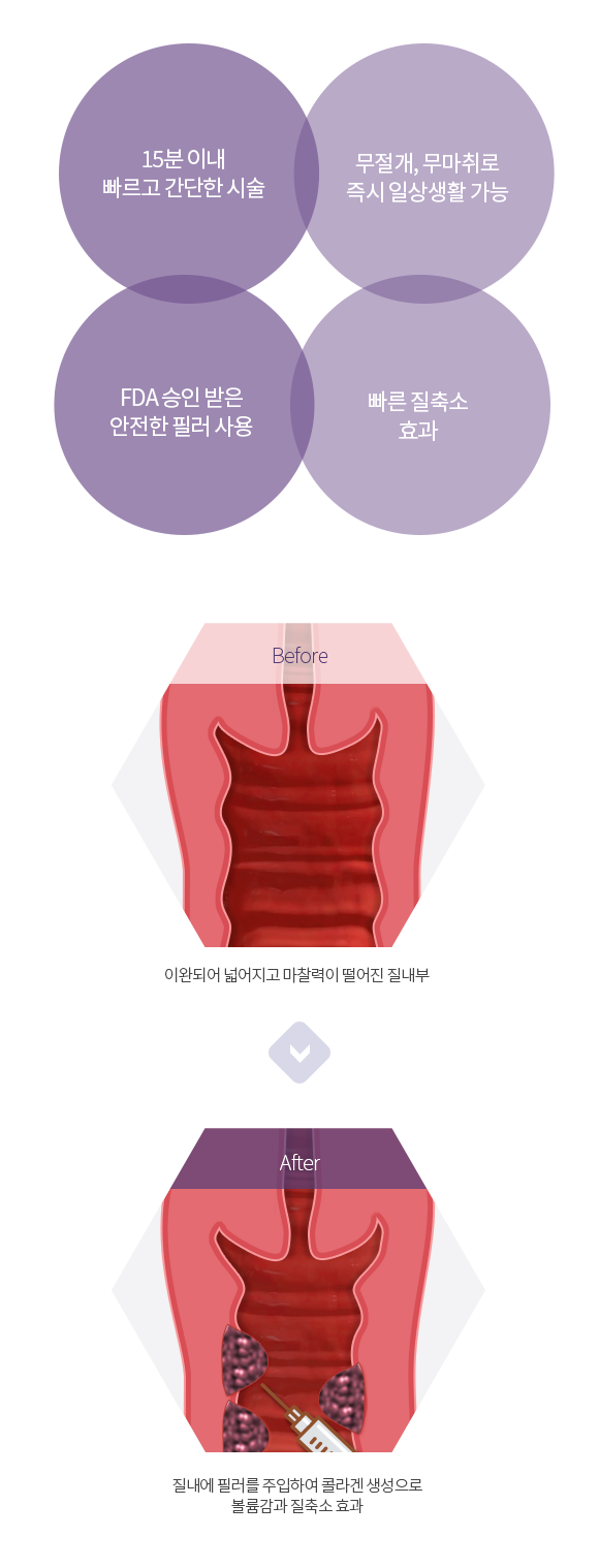 질필러